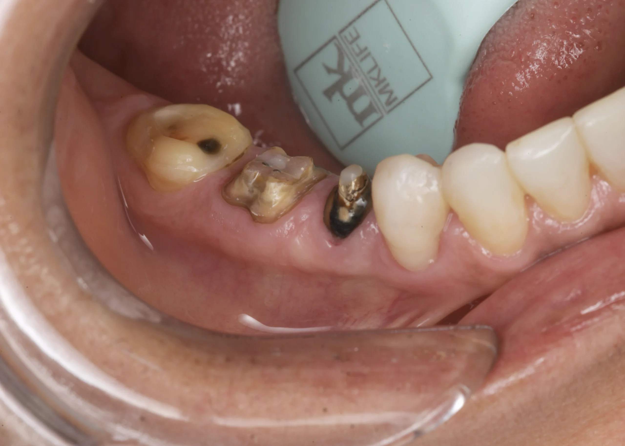 CASOS-THIAGO-KEY.005-scaled.webp CASOS-THIAGO-KEY.005-scaled.webp