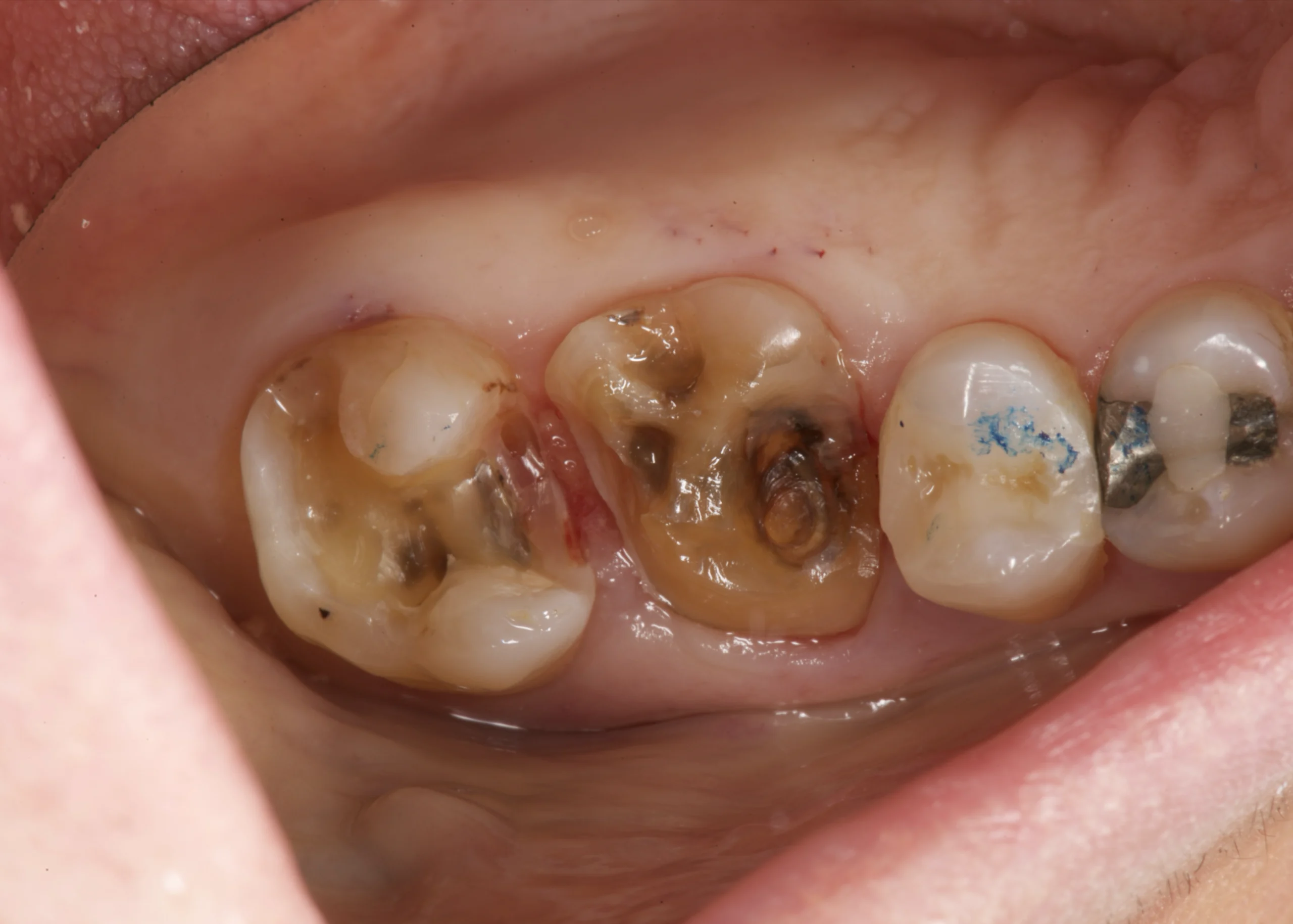 CASOS-THIAGO-KEY.011-1-scaled.webp CASOS-THIAGO-KEY.011-1-scaled.webp